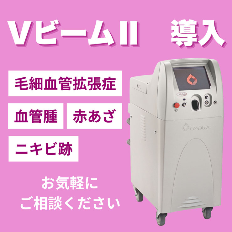 Vビームの治療バナー